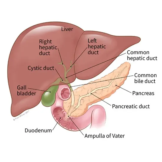 Extrahepatic Bile Duct Cancer